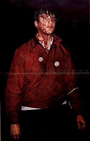 Columbia University 1968 - Student with head wound