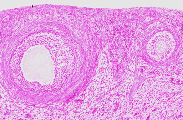  Ovaries. Histology 