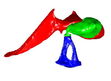 Middle Ear 1