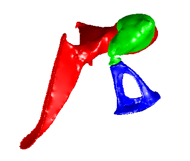 Middle Ear 2