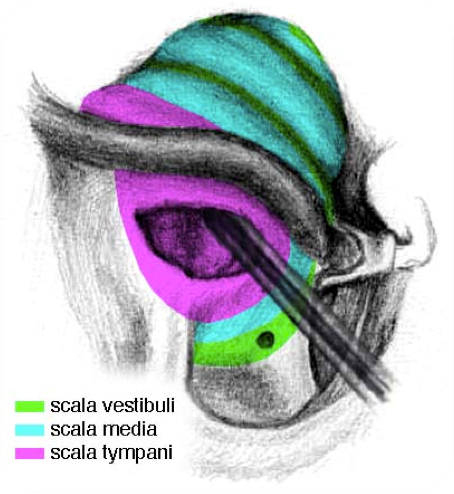 CI1