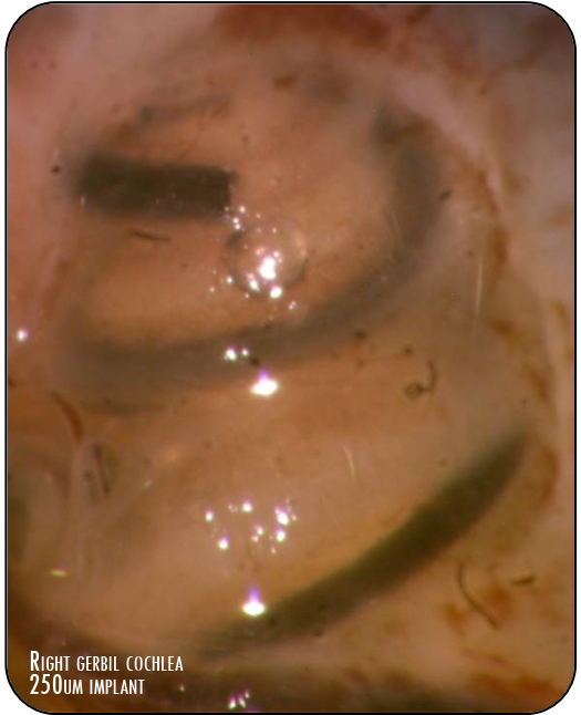 Right gerbil cochlea 250µm implant CI3