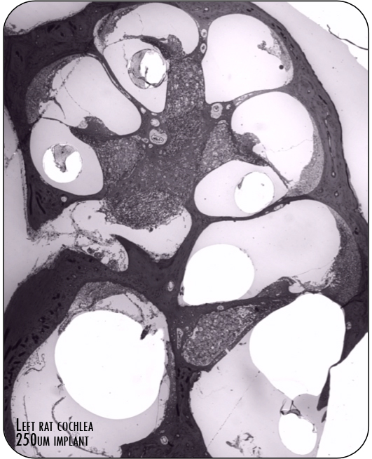 Left rat cochlea 250µm implant CI4