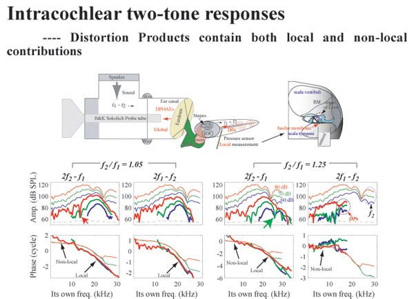 [Intracochlear Distortion Products]