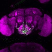 adultbrain