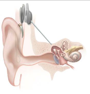 cochlea