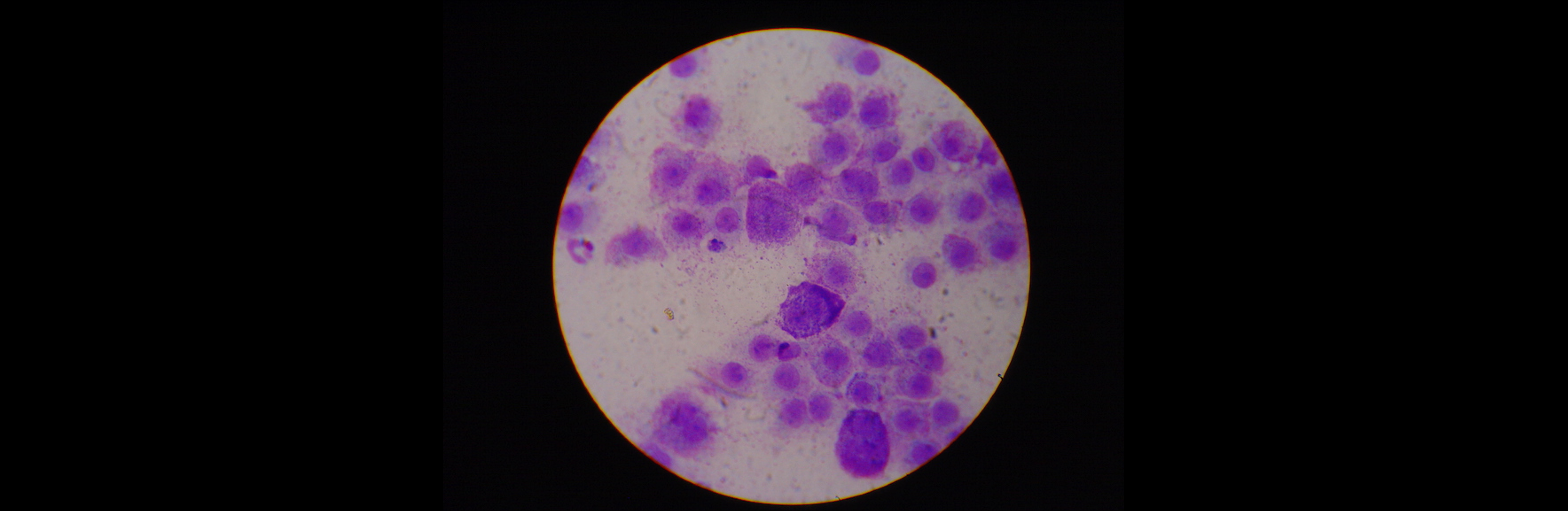 Mast Cells