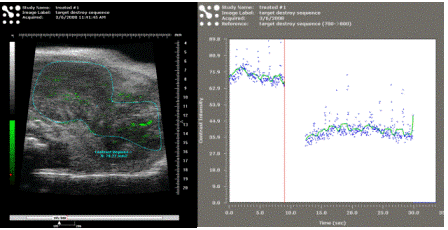 molecular imaging.gif