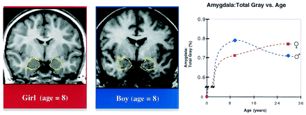 A Brain Divided