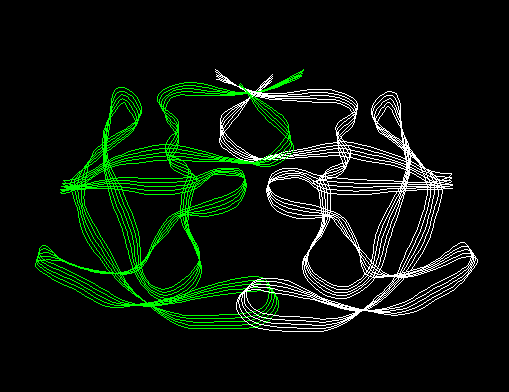 Ribbon of HIV