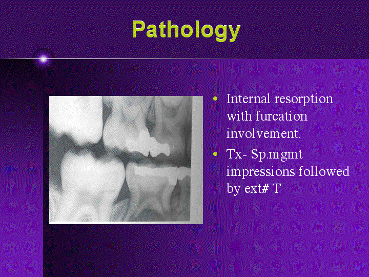 PowerPoint Presentation Local Anesthesia for the Pediatric Patient