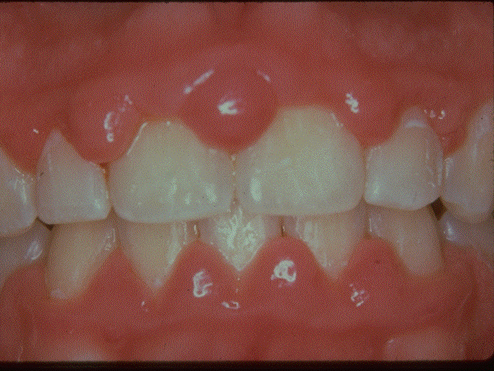 pediatric dentistry admission essay Admission requirements: , oral surgery, pediatric dentistry, periodontics, preventive dentistry, prosthodontics candidate essay. pediatric dentistry admission essay Admission requirements: , oral surgery, pediatric dentistry, periodontics, preventive dentistry, prosthodontics candidate essay.