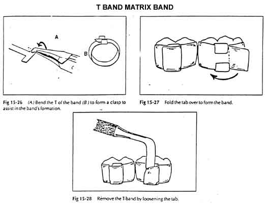 T Band