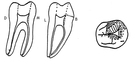 Average Human Tooth Size Chart