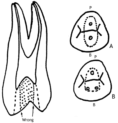 Average Human Tooth Size Chart