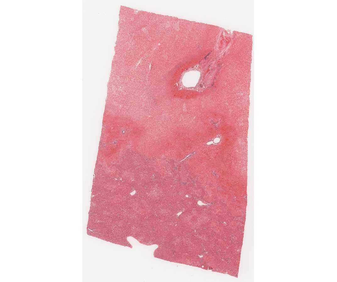Liver1