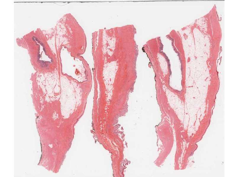 makeup referred abdominal pain. referred abdominal pain. of abdominal pain. referred abdominal pain. makeup referred abdominal pain. referred abdominal pain. of abdominal pain.