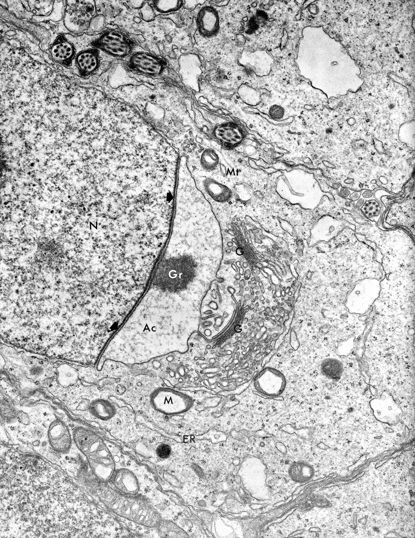 Spermiogenesis (sperm maturation), Golgi phase