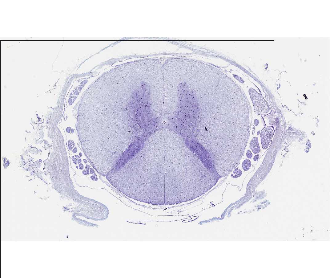 #85 Spinal Cord, Human, Cat Cross section (Nissl stain)