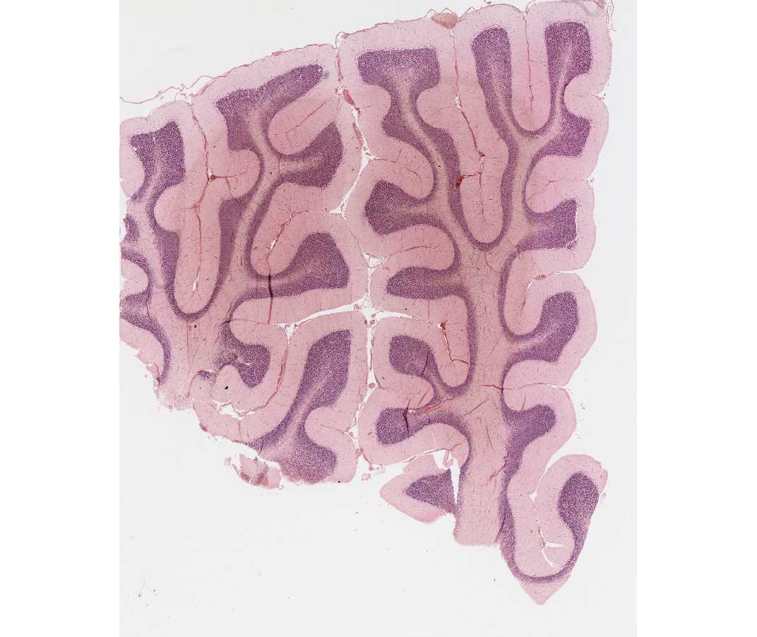 #86 Cerebellum, Human