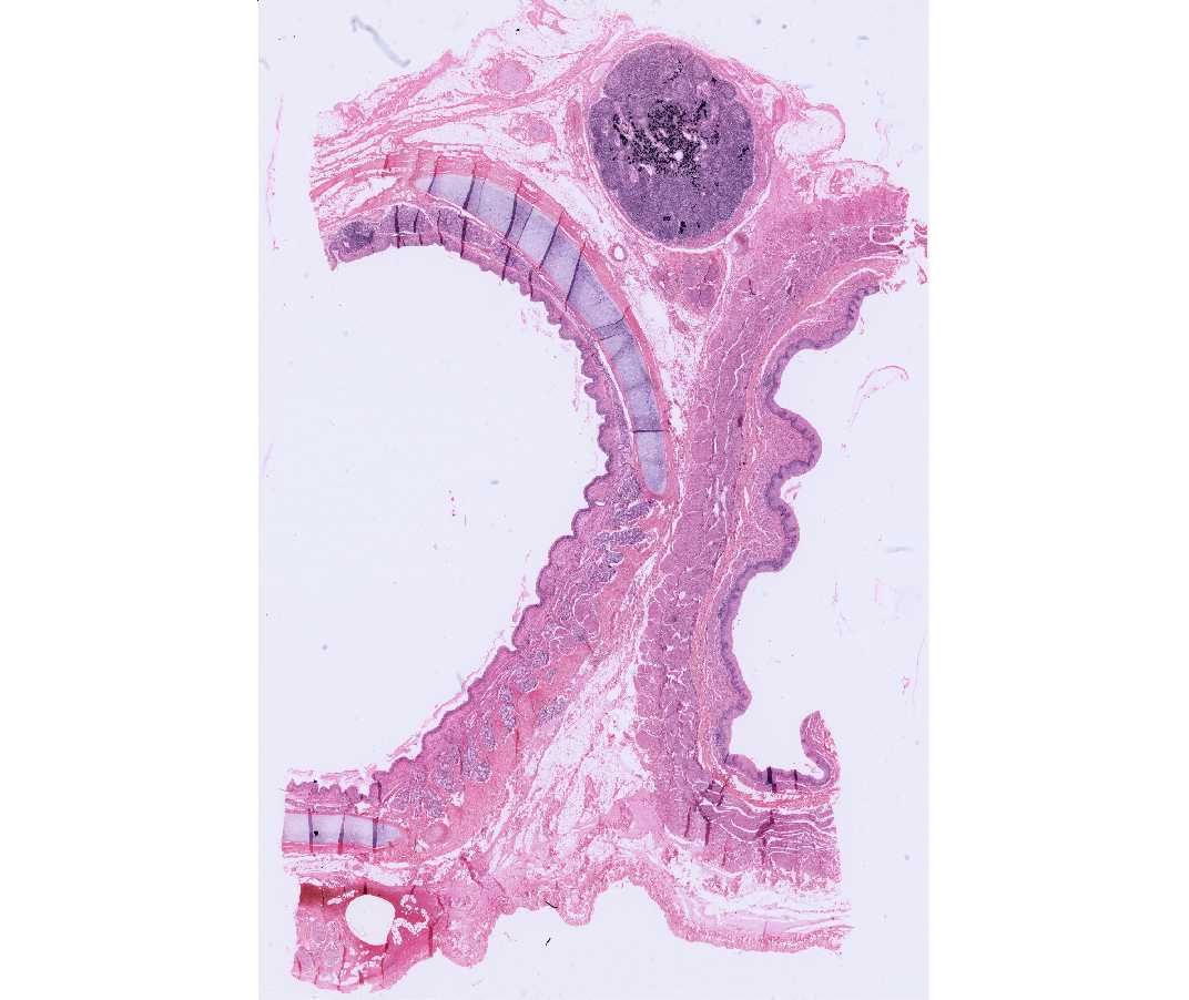 peripheral nerve histology cross section