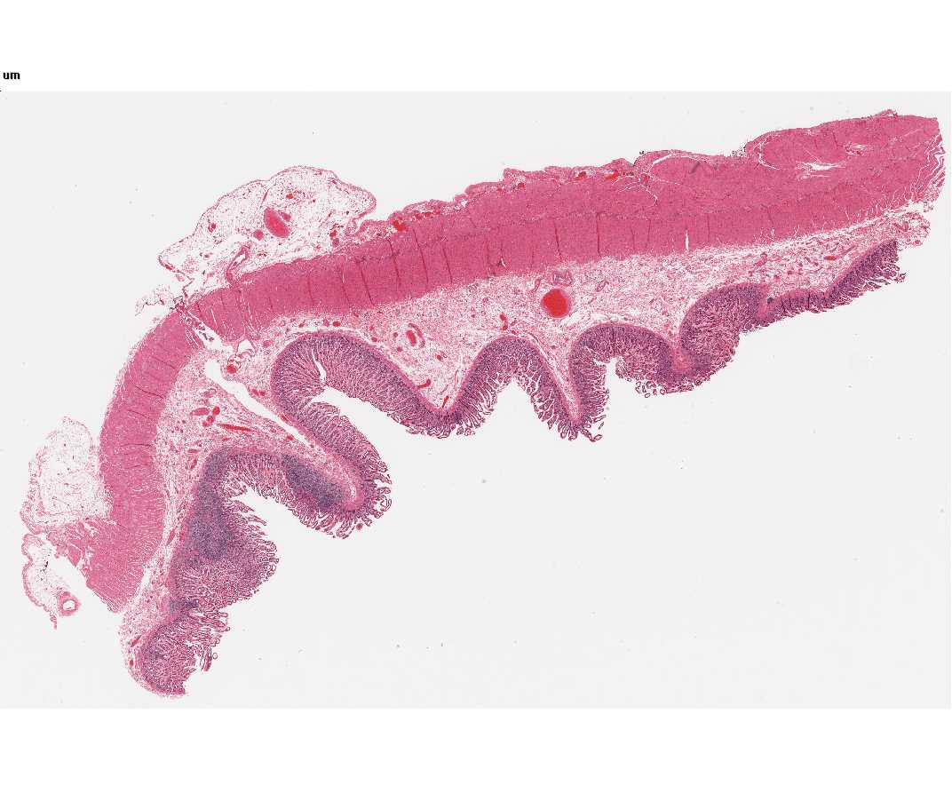 <strong>#117 Small Intestine, Human, Dog or Rabbit, H&E</strong>