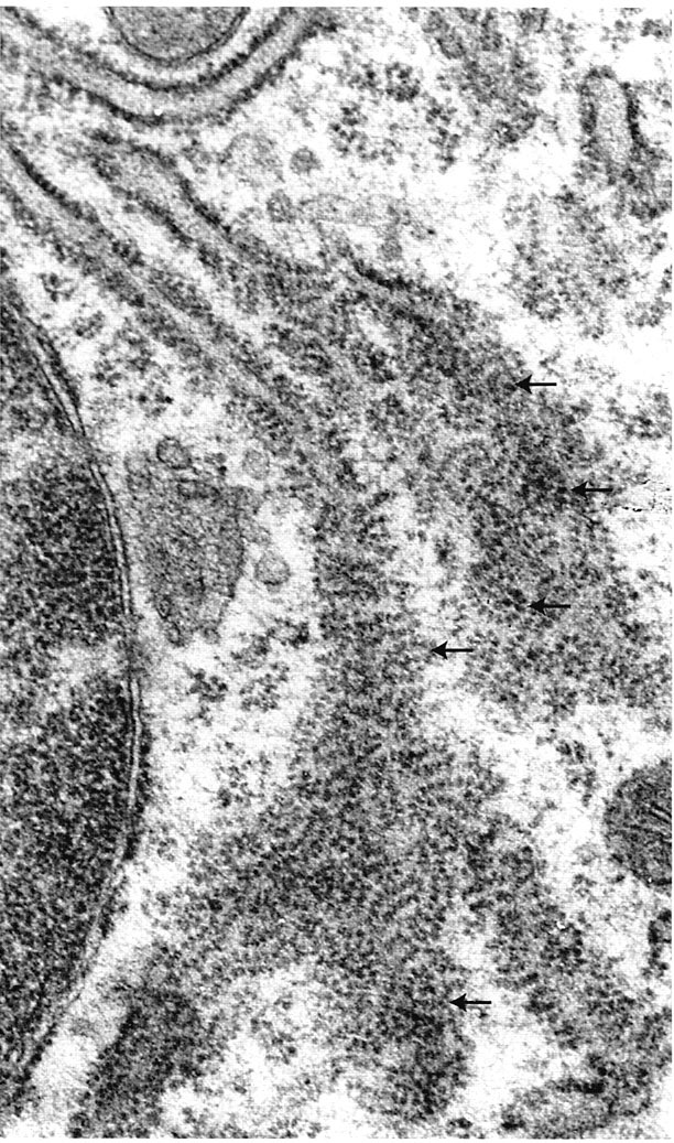 Rough endoplasmic reticulum and polyribosome complexes