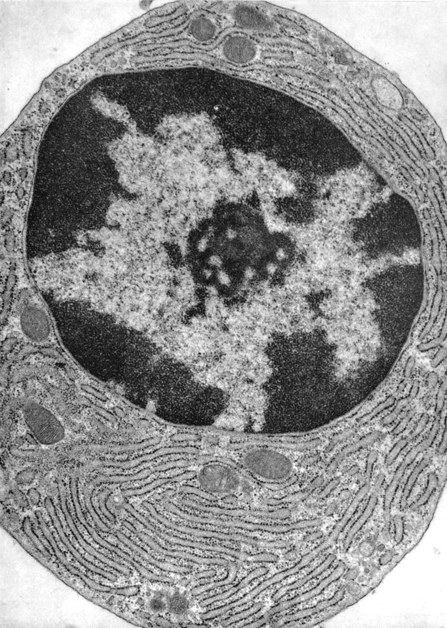 Plasma Cell Histology