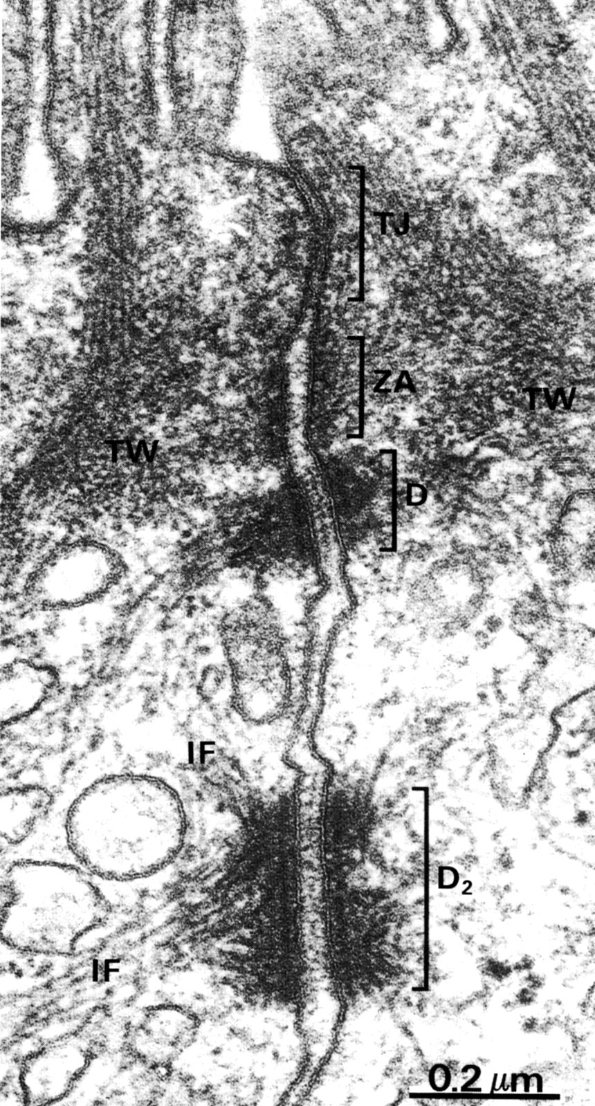 Junctional Complex