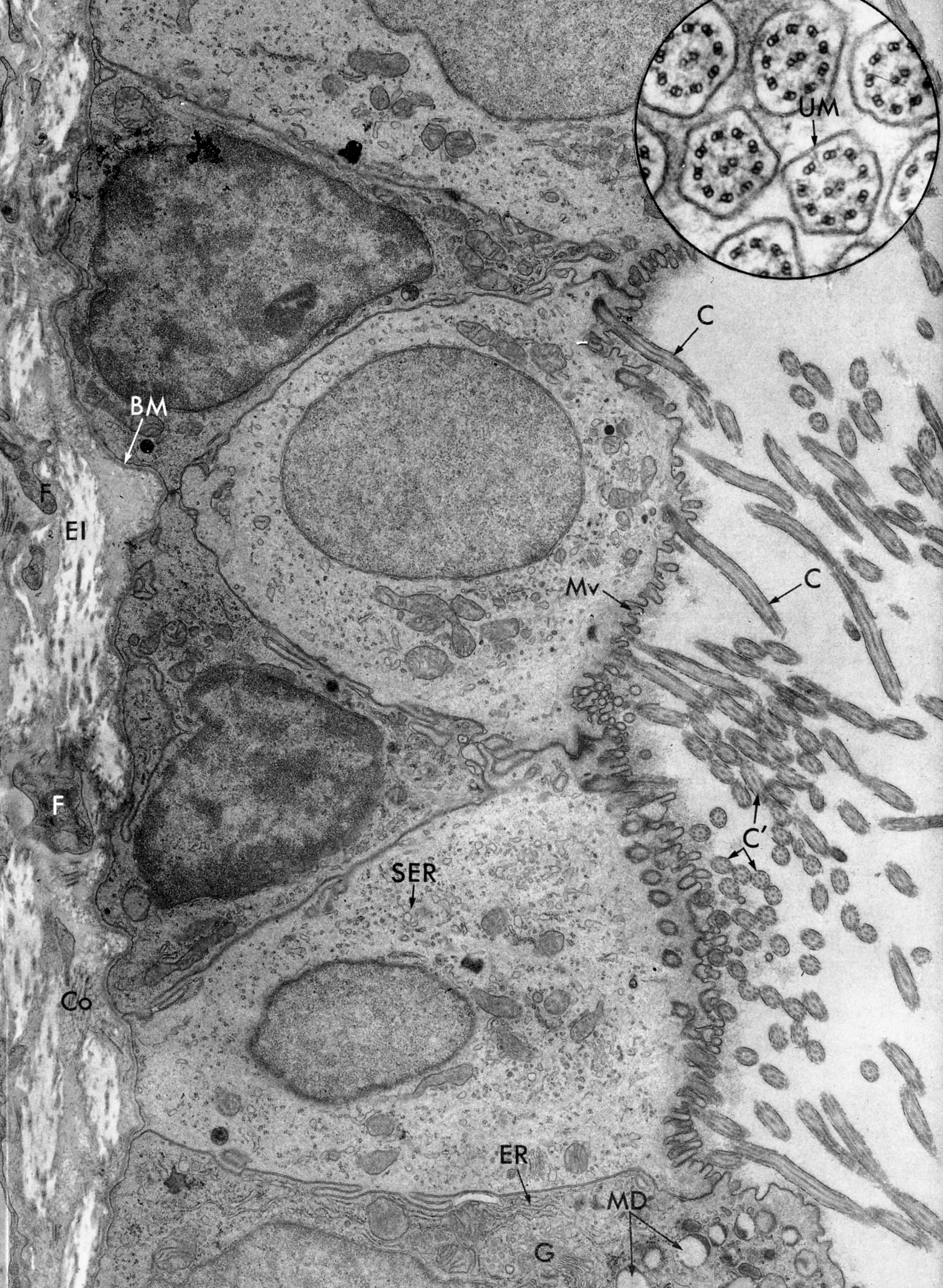 Tracheal lining with ciliated cells