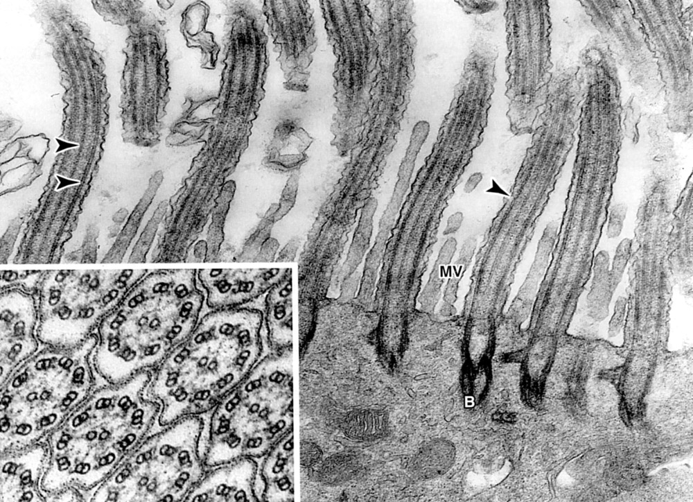 Ciliated epithelium with microvilli