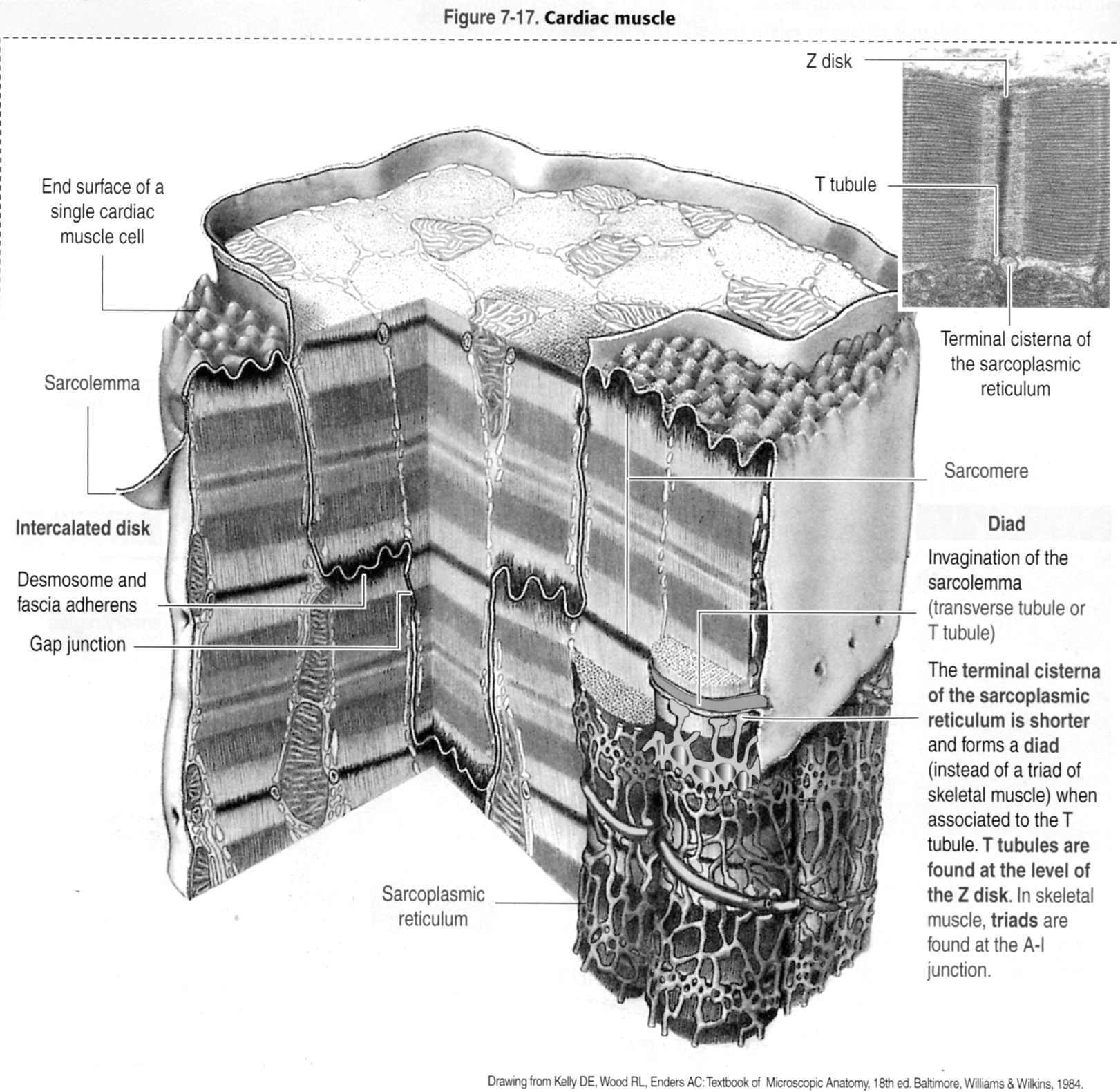 Schematic Diagram of Cardiac Muscle