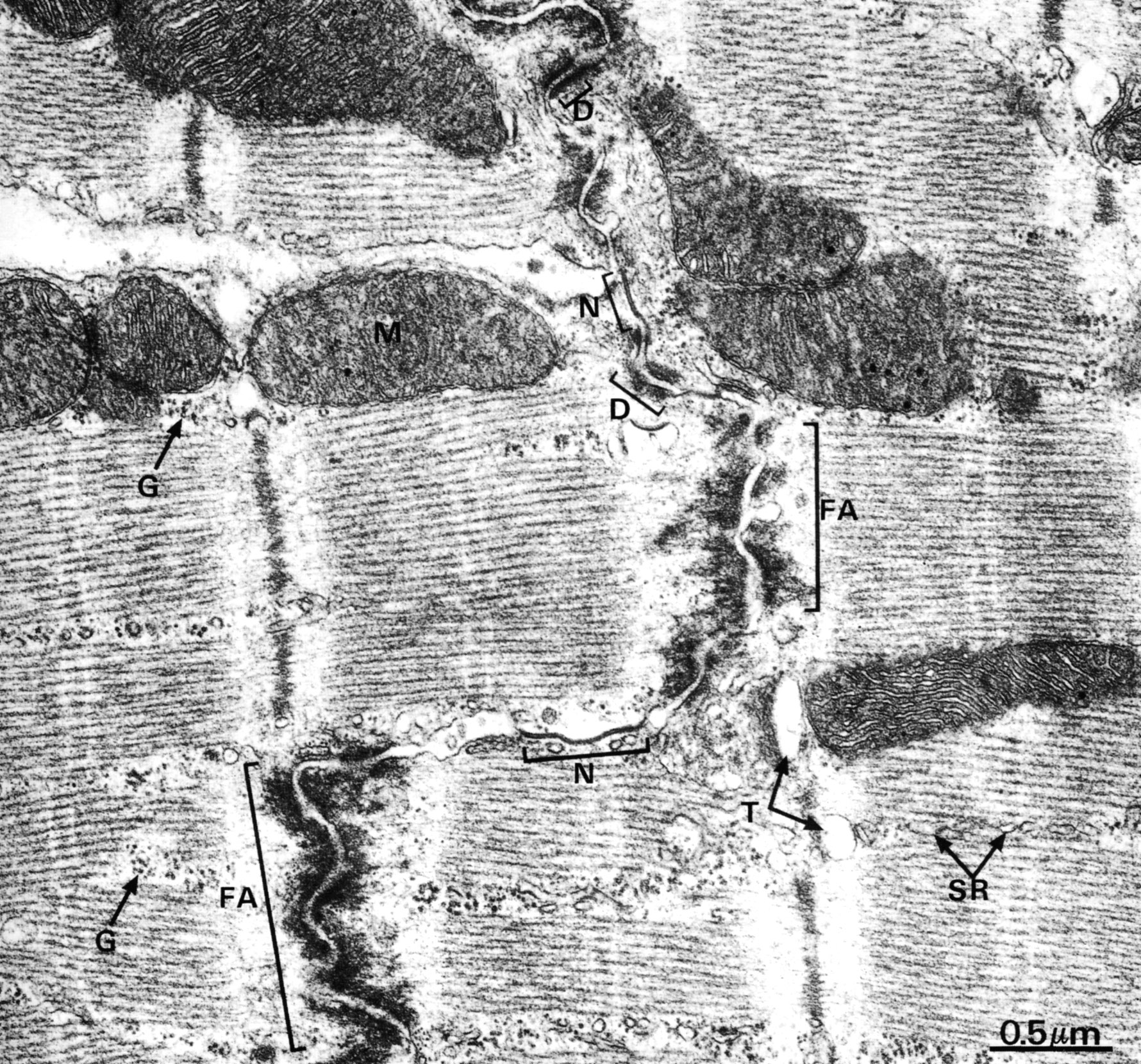 Intercalated Disc Histology