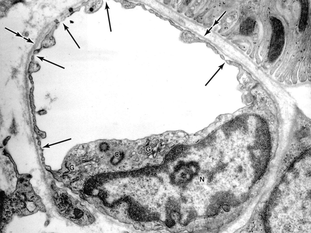 Fenestrated capillary (nonglomerular region of kidney)