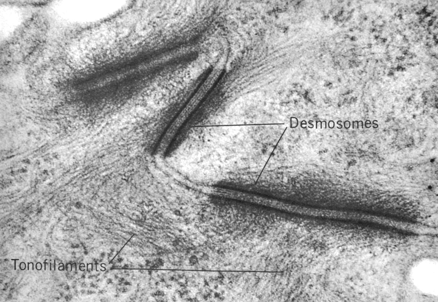 Desmosomes in  stratum spinosum
