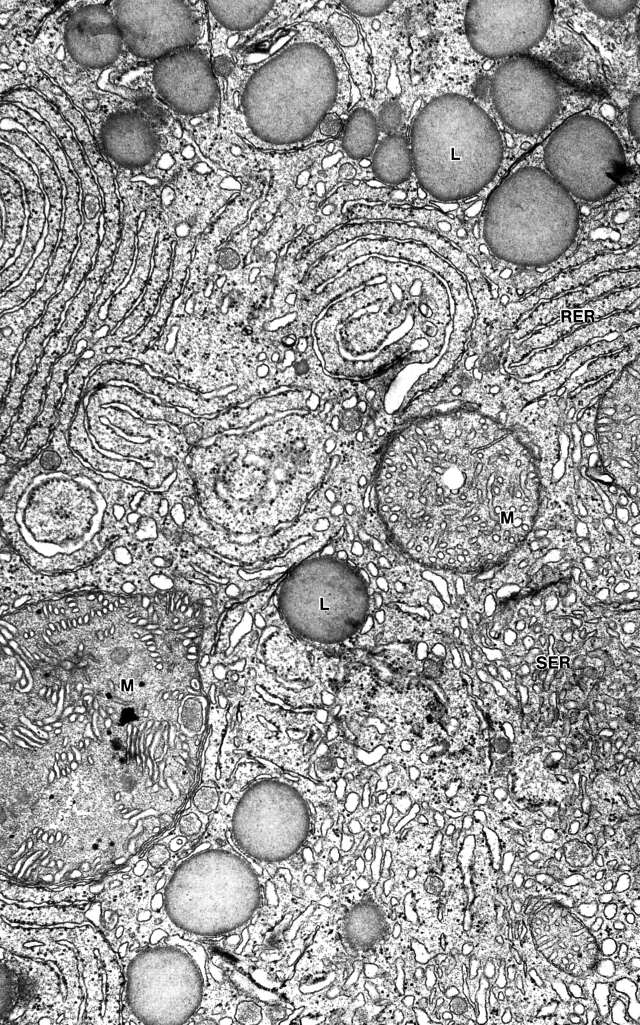 Granulosa cell, pregnant human