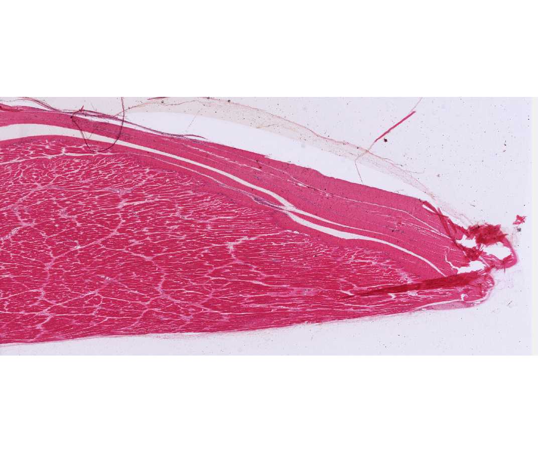 #3 Muscle and Tendon, Human, H&E 