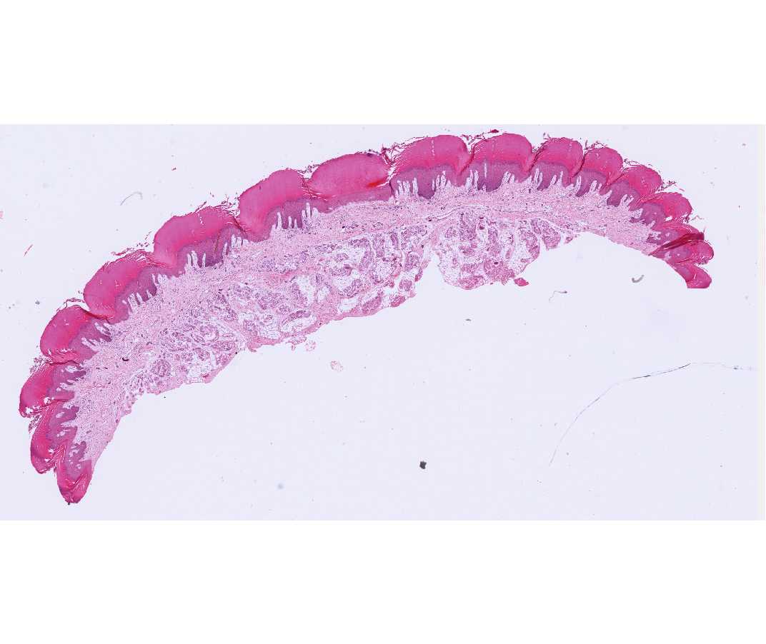 #4 Skin, thick skin, volar surface, monkey H&E