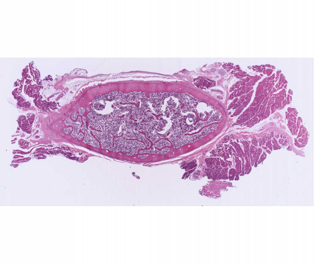 #11 Bone, rib (H&E)