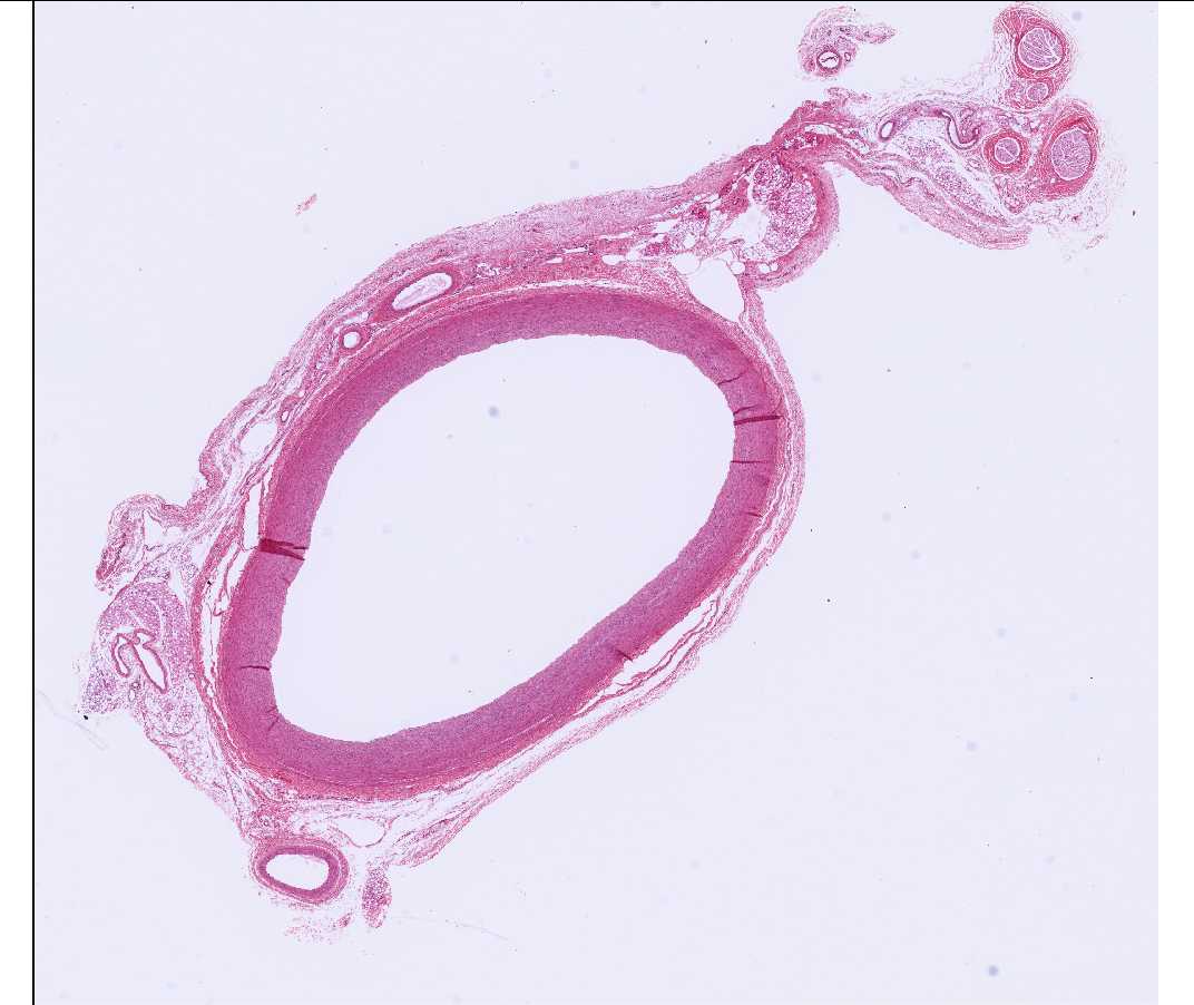 #16 Aorta, Rhesus monkey, Cross Section