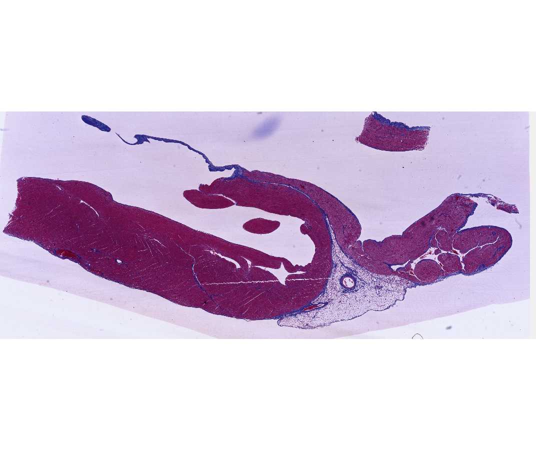 #17 Heart, Monkey, Sagittal Section