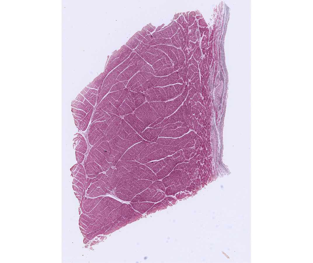 #19 Heart, Ventricle, Calf (PTAH Stain)