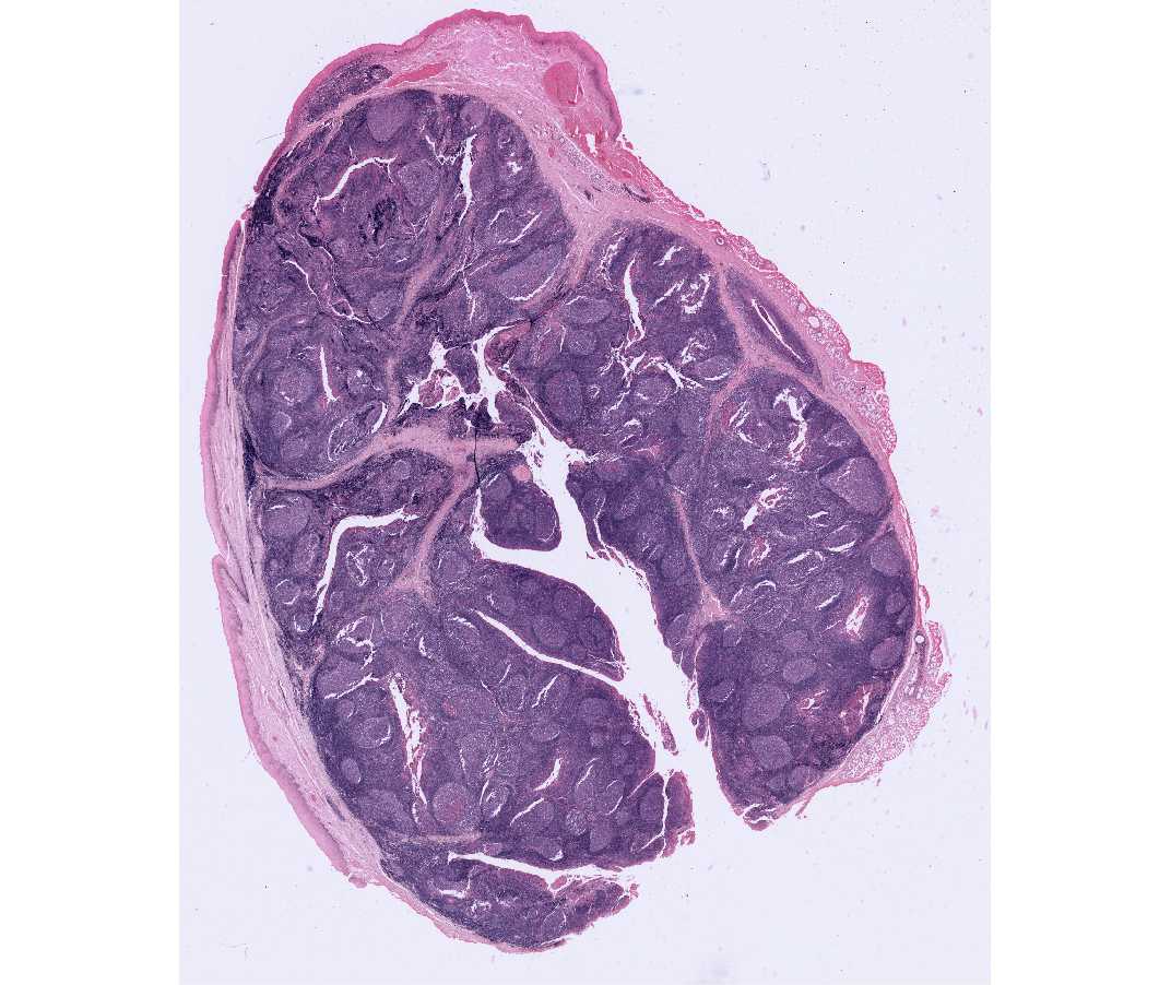 thymus gland slide