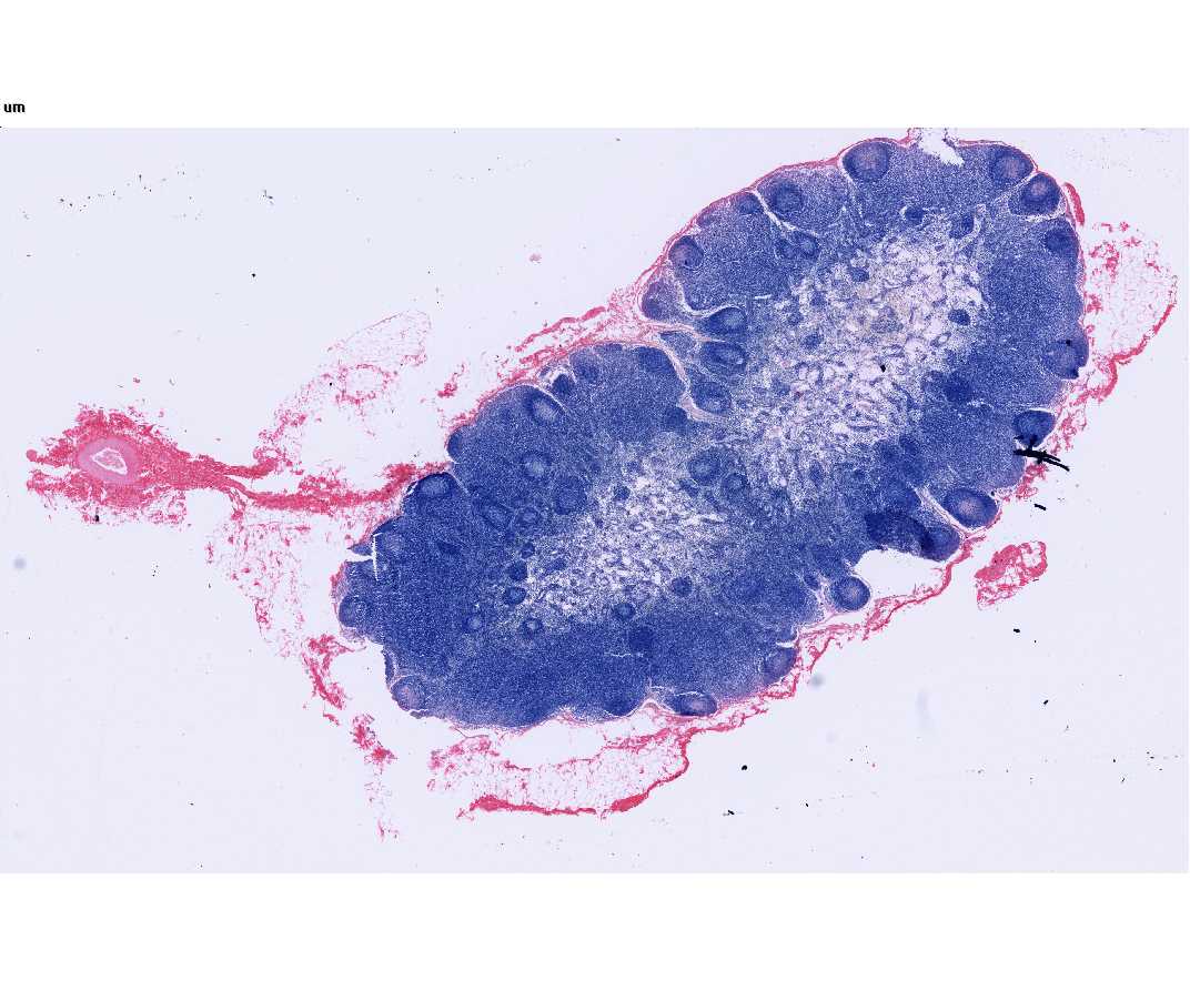 #31 Bronchial lymph node, Monkey (H & Azure II-Eosin)  