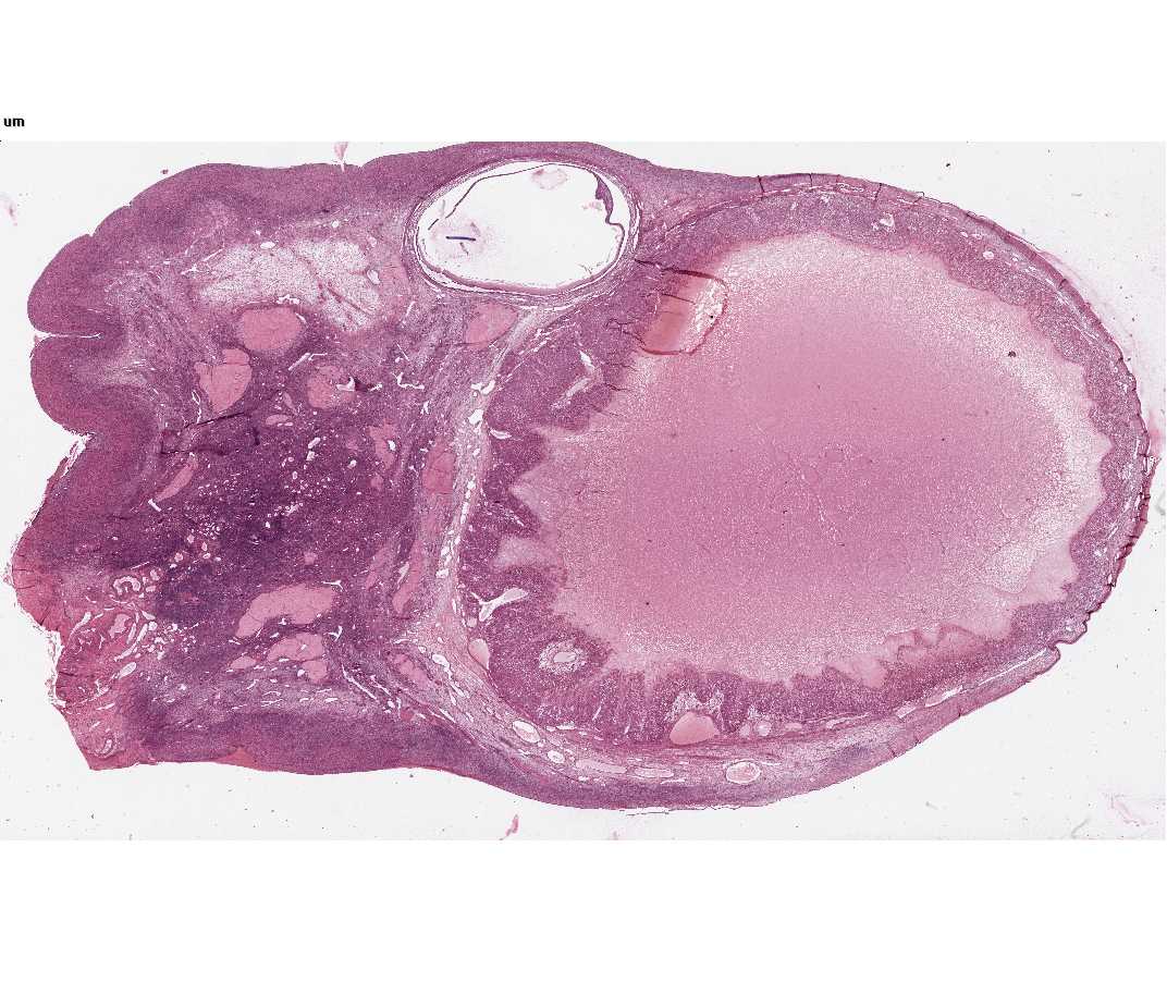 #63 Ovary, Adult Human (Mallory's trichrome or H&E)