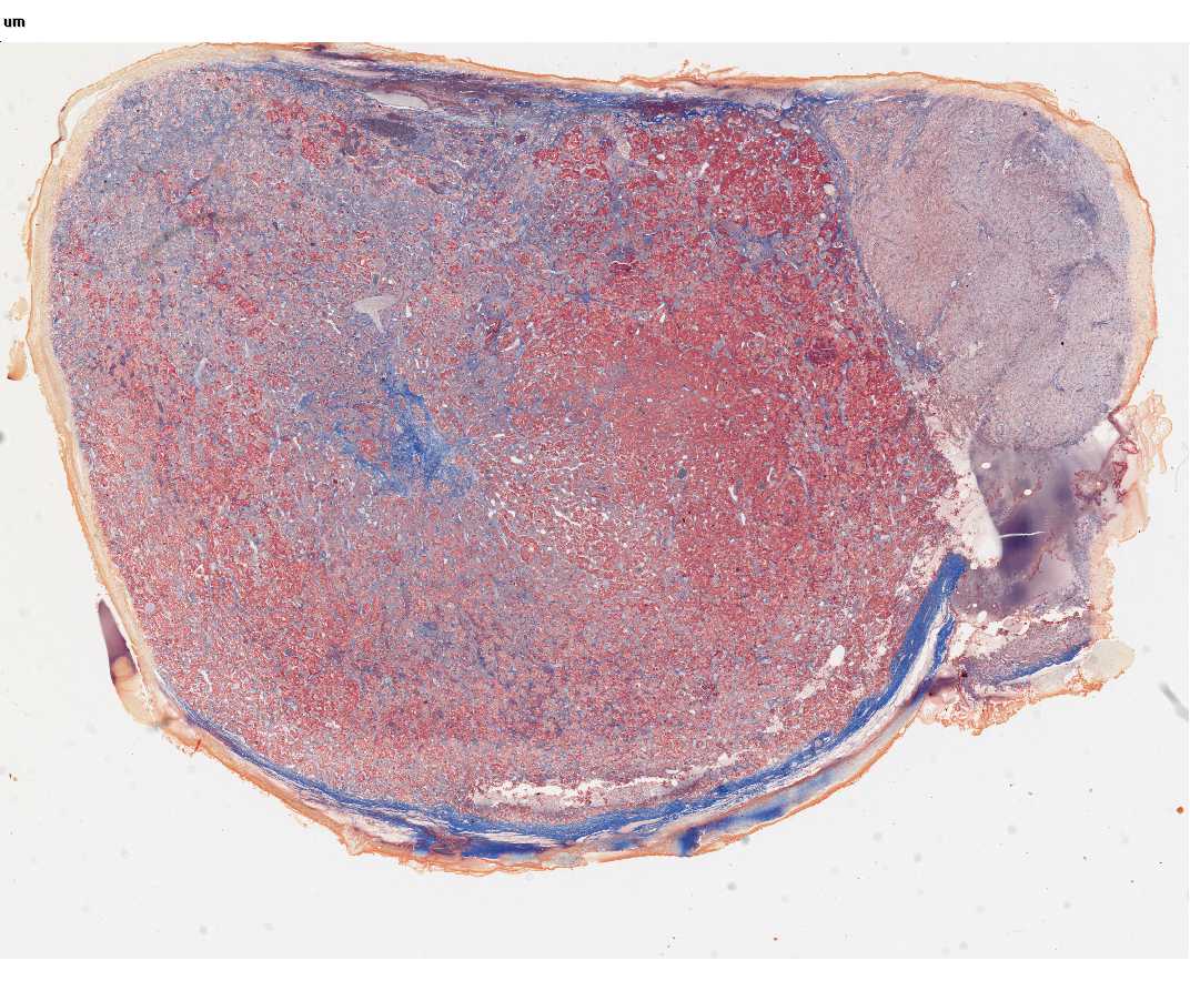 #73 Pituitary, Human (Masson's trichrome)