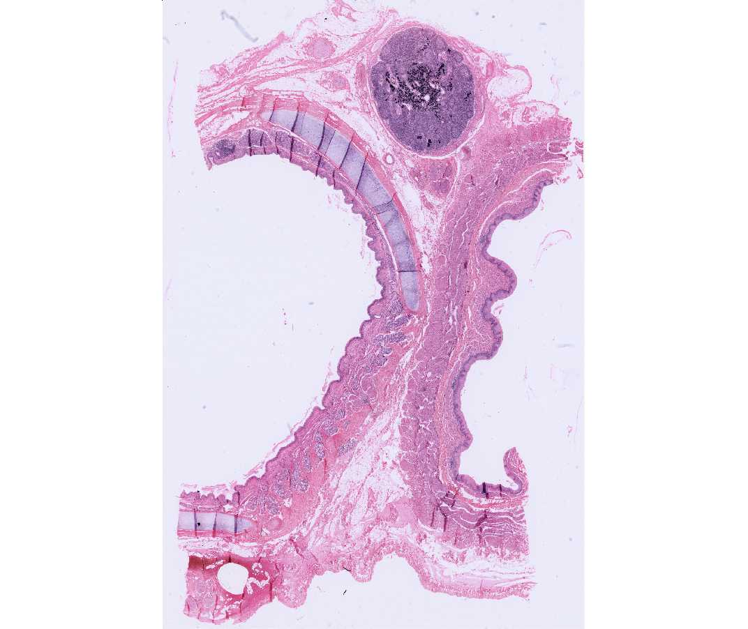 trachea histology