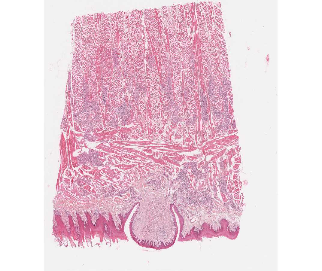 fungiform papillae pictures