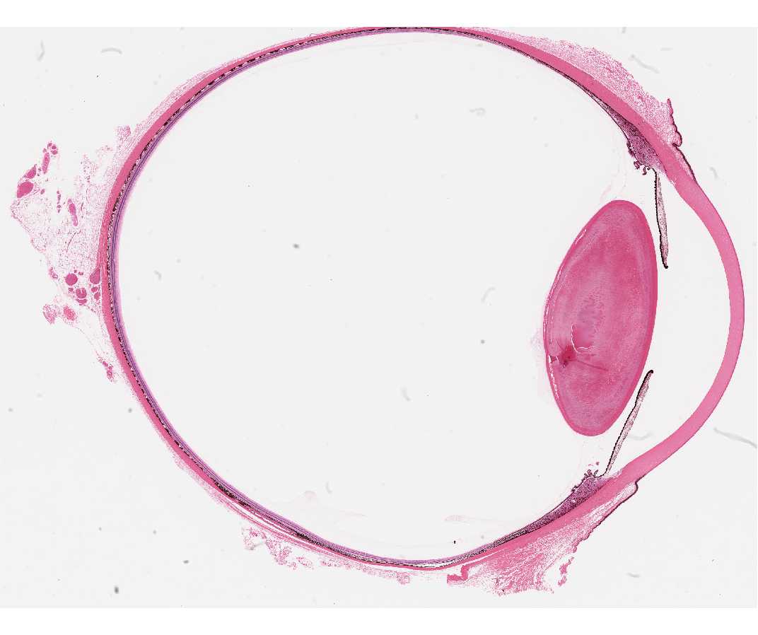 #119. Eye, sagittal section