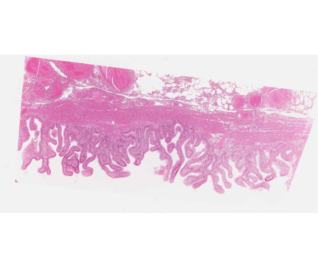 #115 Gall bladder, Hematoxylin & eosin (H&E)